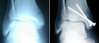 sidebyside.jpg