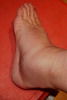 photo thumbnail #14