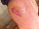 photo thumbnail #1