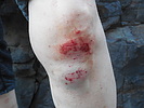 photo thumbnail #3
