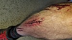 photo thumbnail #1